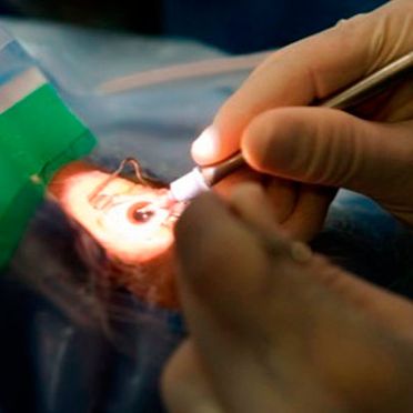 Clínica Oftalmológica Dr. Juan Manuel Palomares cirugía de ojos