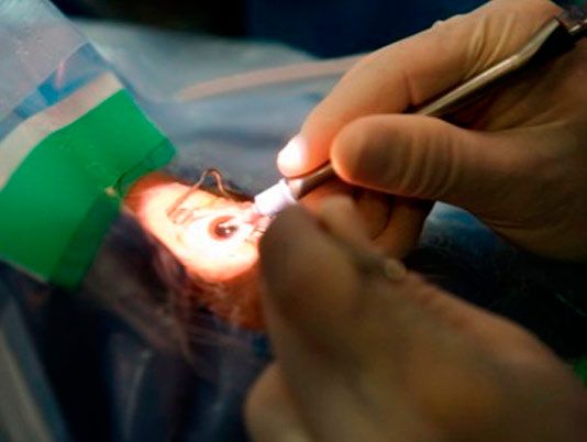 Clínica Oftalmológica Dr. Juan Manuel Palomares cirugía de ojos en Motril 